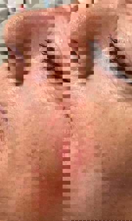 Ergebnis