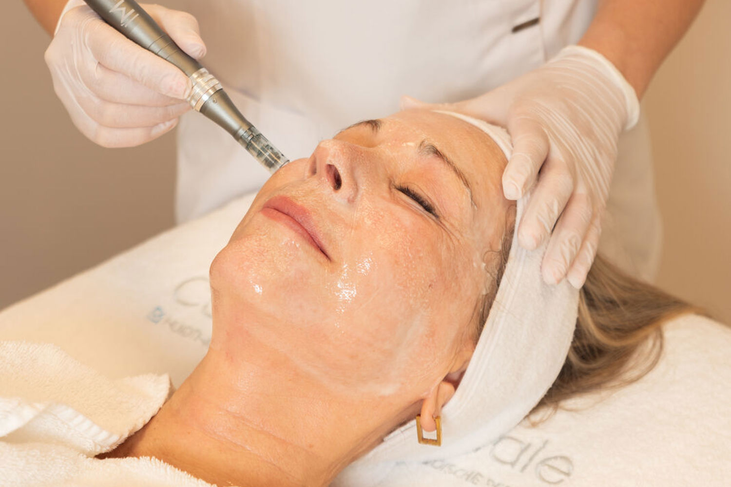 Hydraneedling Met Hyaluronzuur