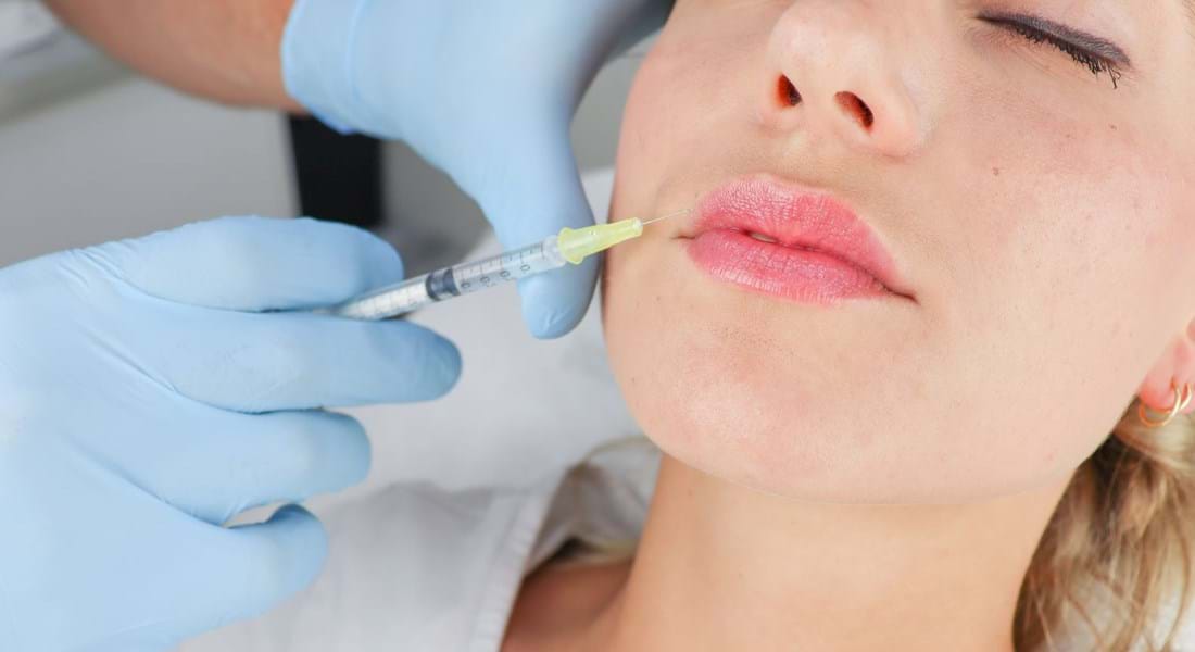 Lipfillers Injectables
