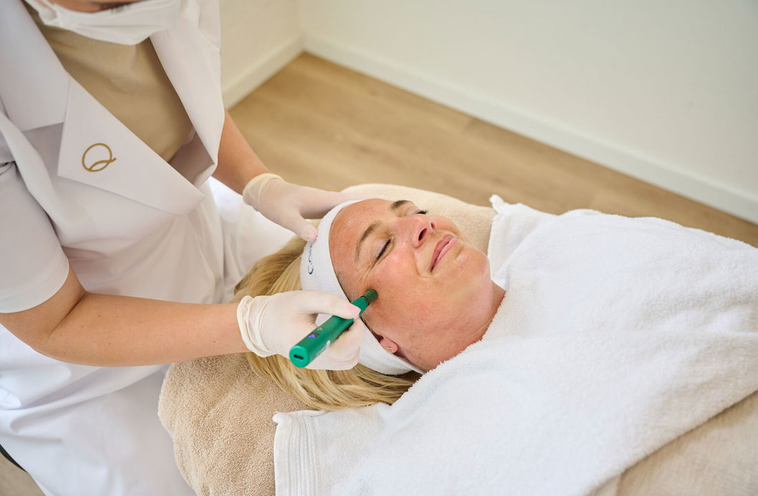 Microneedling behandeling bij Cosmetique Totale Genk in de Wellness Kliniek