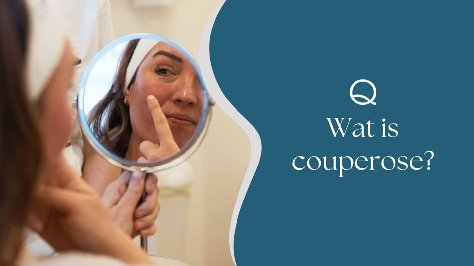 Wat Is Couperose (1)