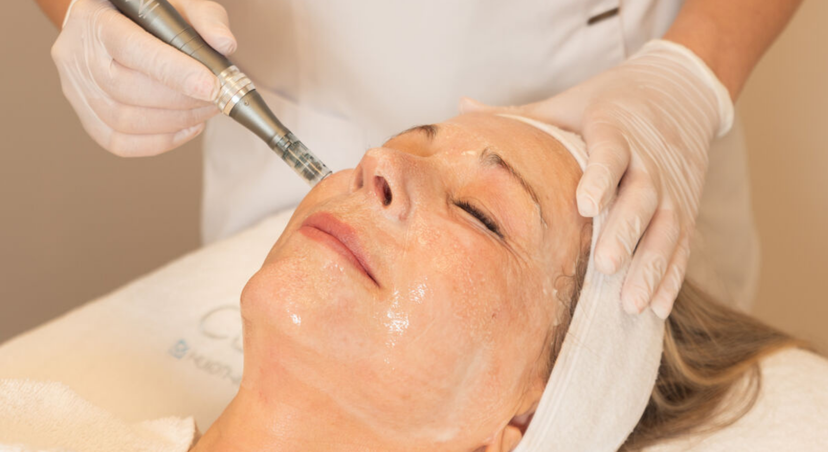 Microneedling behandeling voor huidverjonging bij Cosmetique Totale