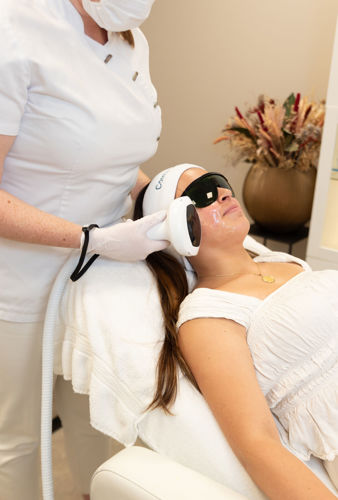 Rosacea Behandeling (4)