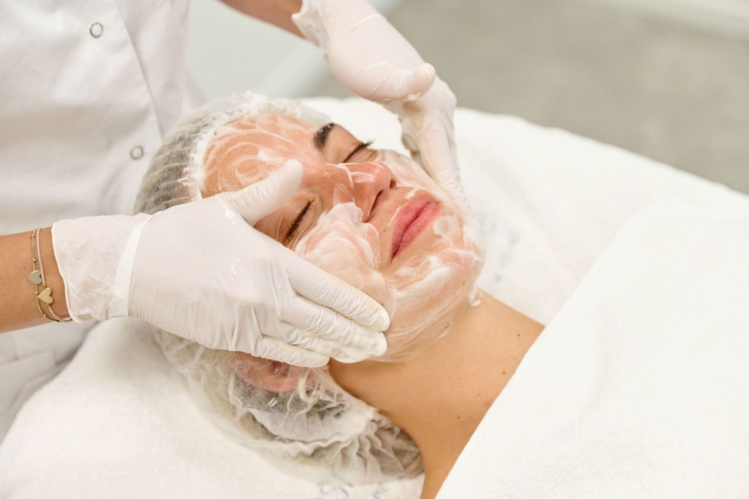 Vergoeding Acne Behandeling 2024