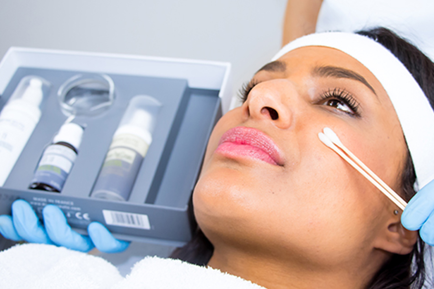 pigmentvlekken verwijderen