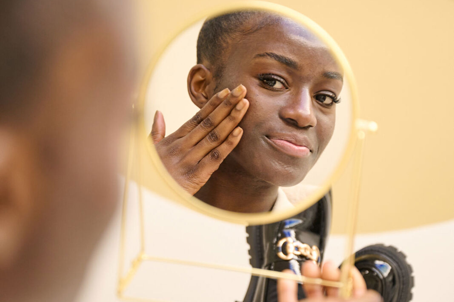 Vormen Van Hyperpigmentatie