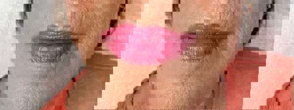 Hautverjüngung Ergebnis 3