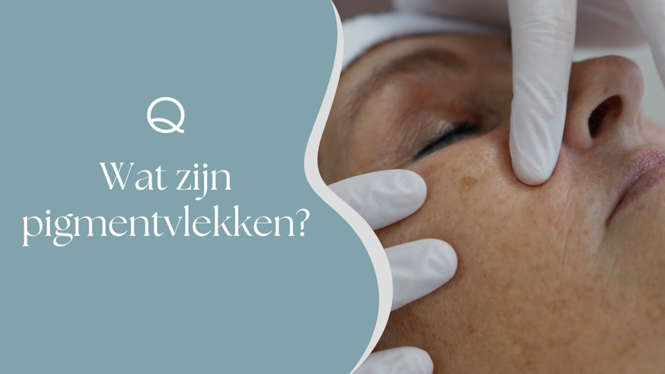 Wat Zijn Pigmentvlekken (2)