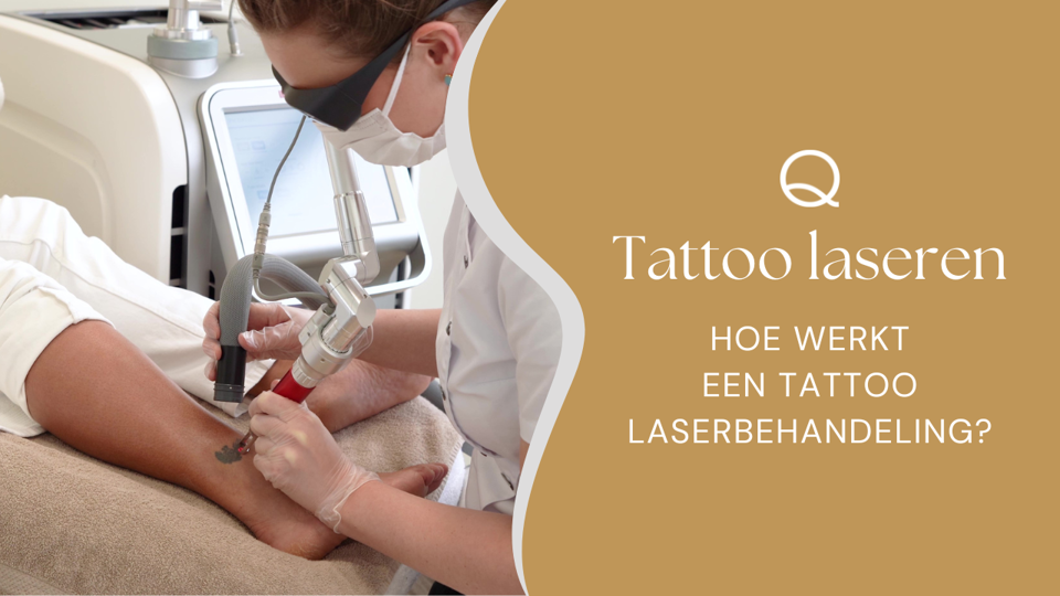 Tatoeage Verwijderen Picolaser Rotterdam