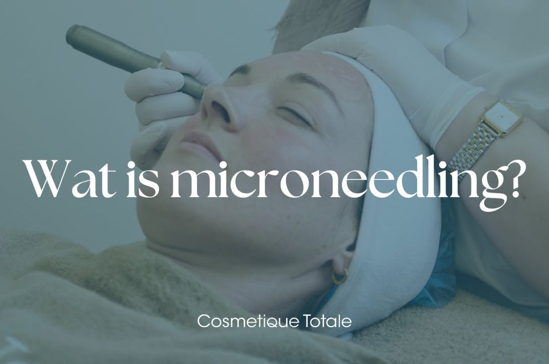 Morpheus8 met microneedling en radiofrequentie bij Cosmetique Totale Hengelo