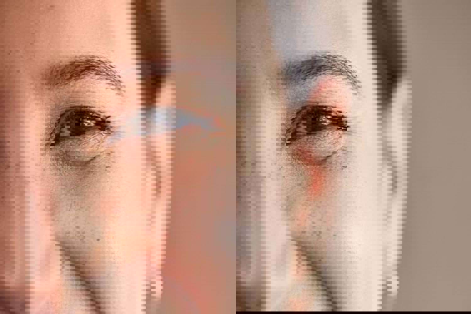 Funktion Der 5 Schichten In Der Oberhaut