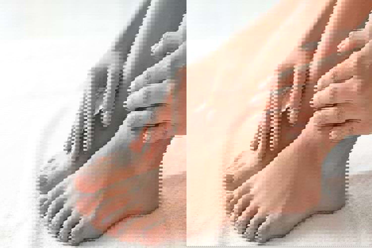 LA MYCOSE DE L'ongle