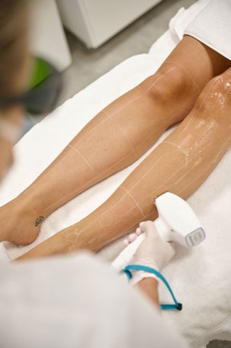 Benen Definitief Ontharen (1)