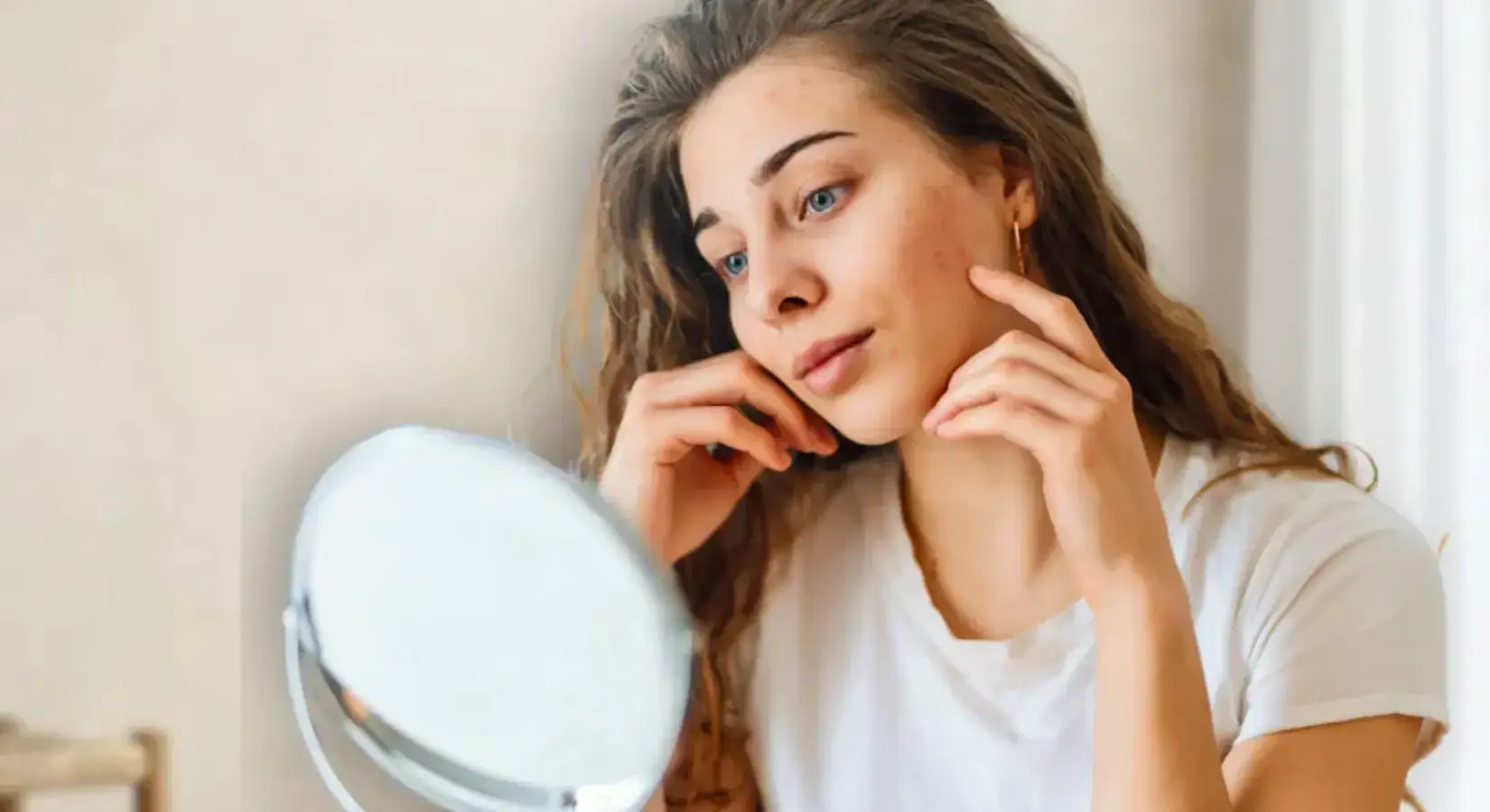 Rosacea In Breda