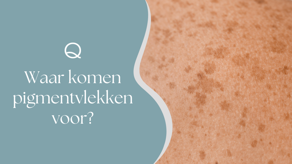 Waar Komen Pigmentvlekken Voor (2)