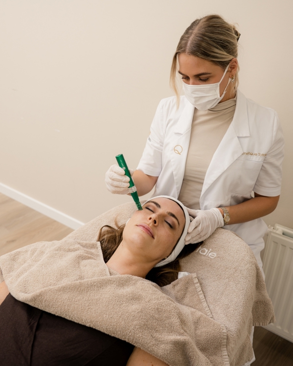 Microneedling (11)