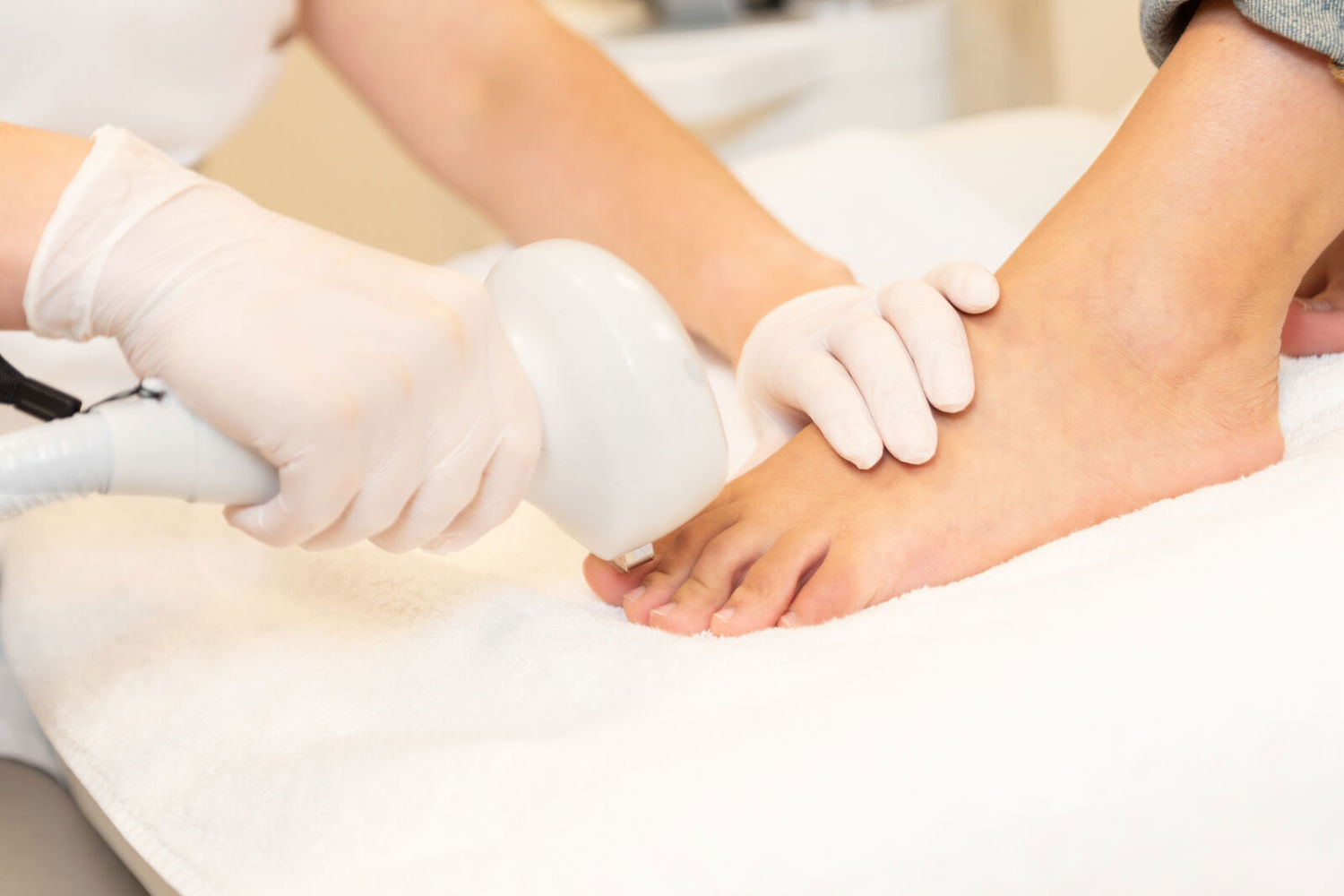 Schimmelnagels Behandelen (1)