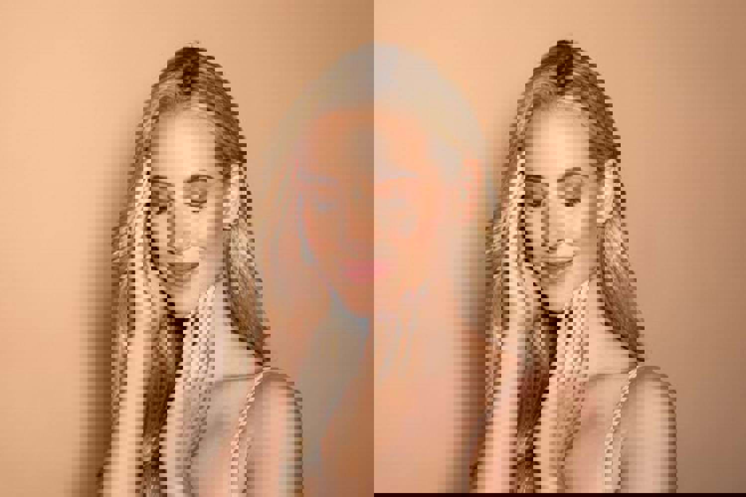 Lagen Der Haut Die Lederhaut