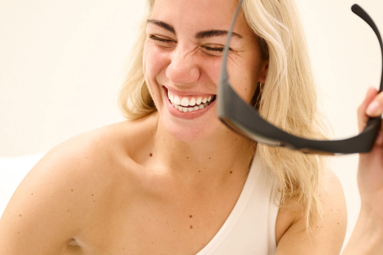 Laserbehandeling Acne Amsterdam