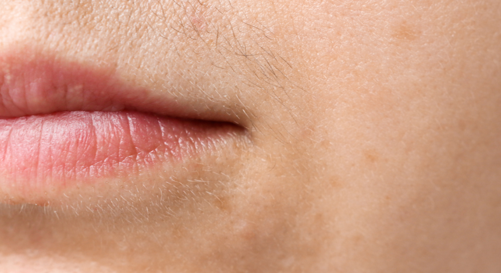 Overbeharing begrijpen, behandelen en leven