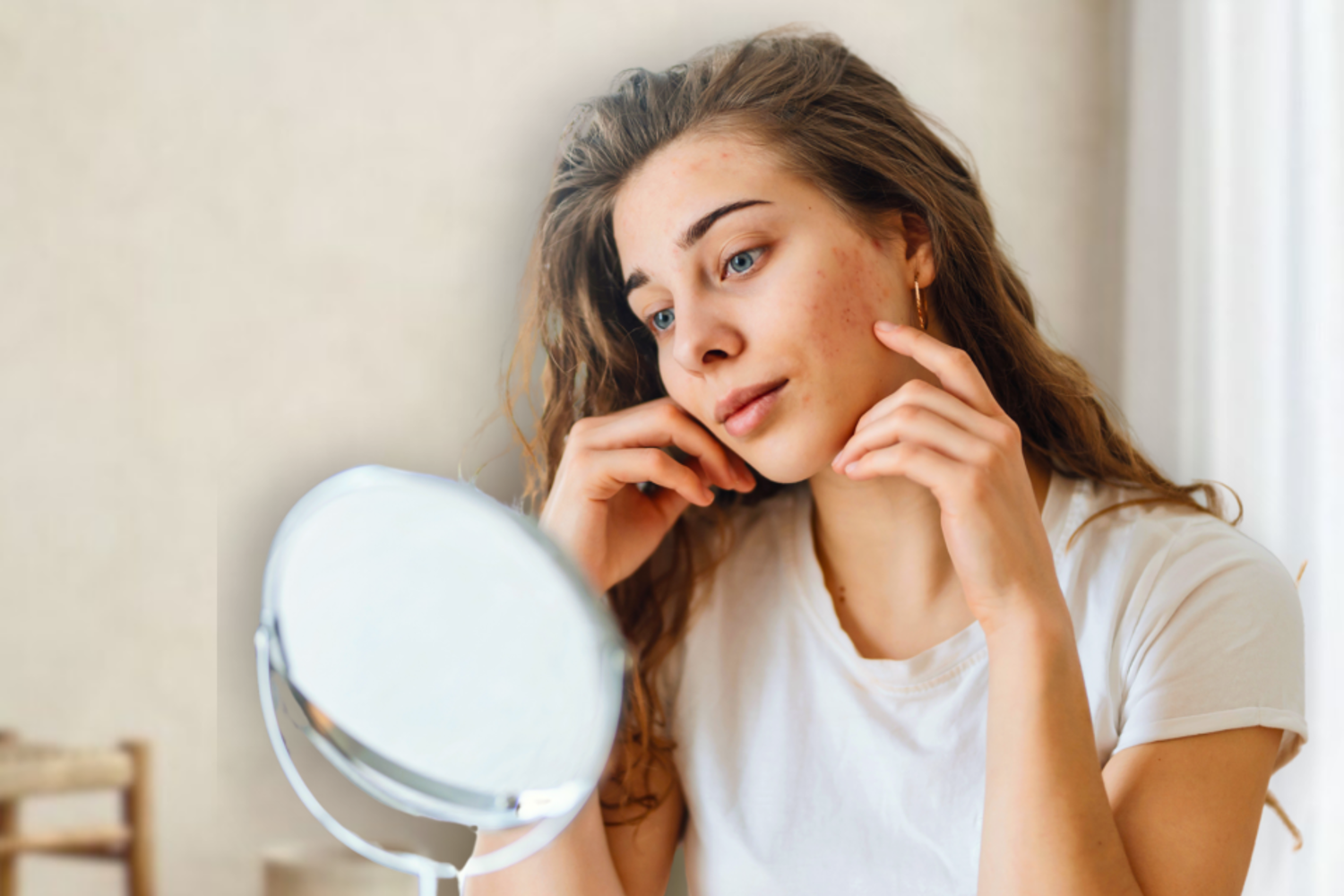 Rosacea Behandeling