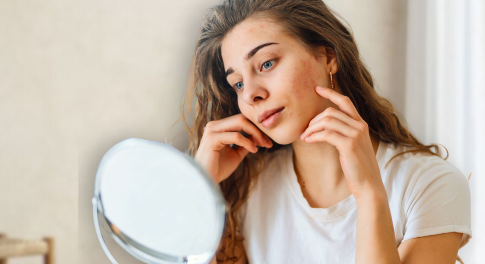 Rosacea Behandeling