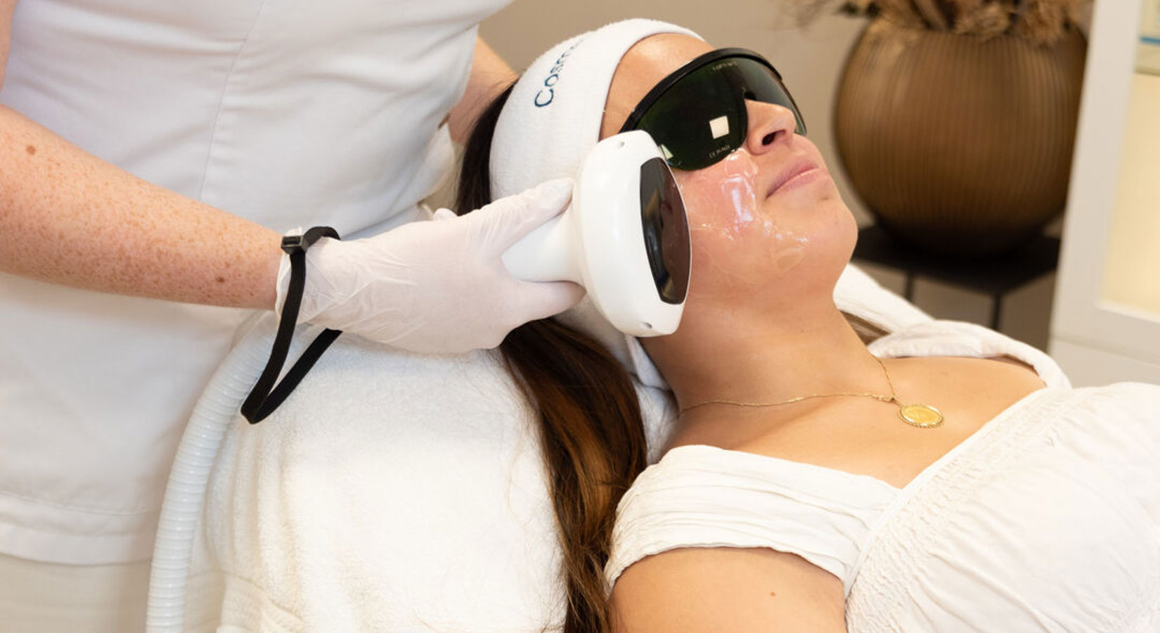 Couperose Behandeling (2)