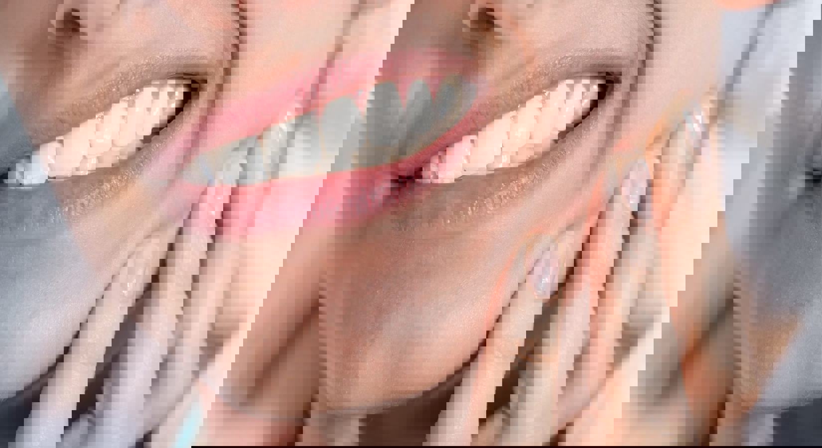 Traitements avec des relaxants musculaires contre le grincement des dents