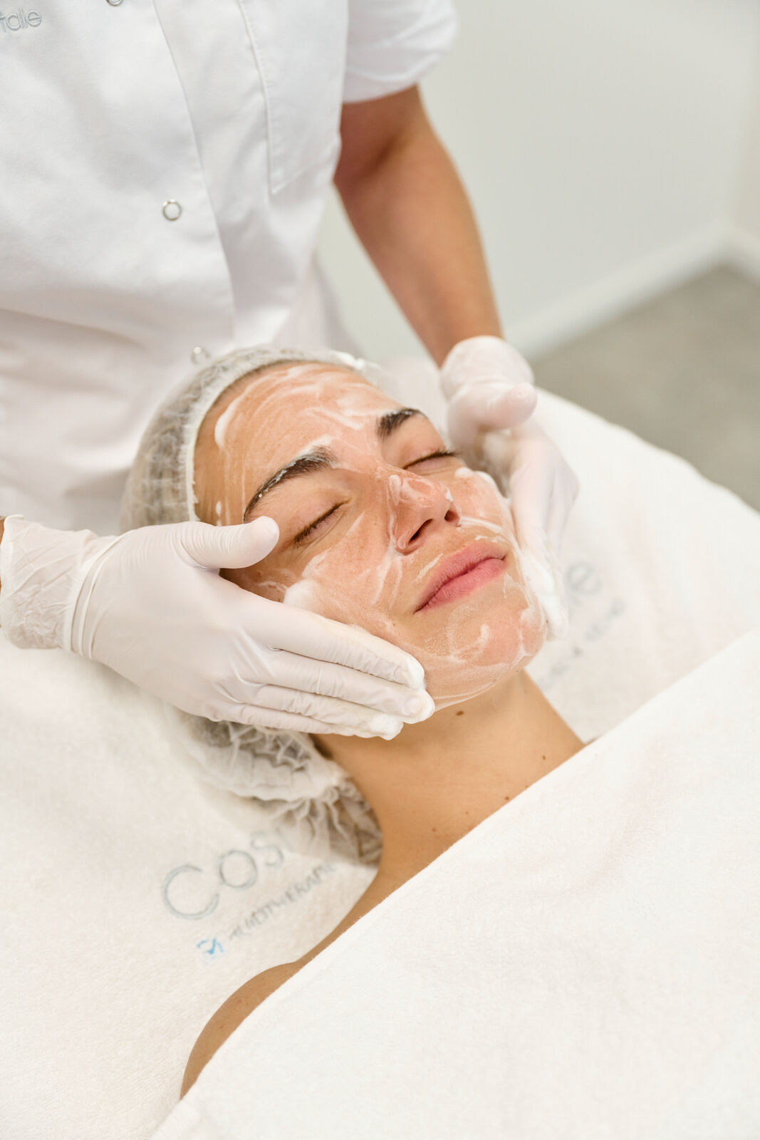 Acne peeling