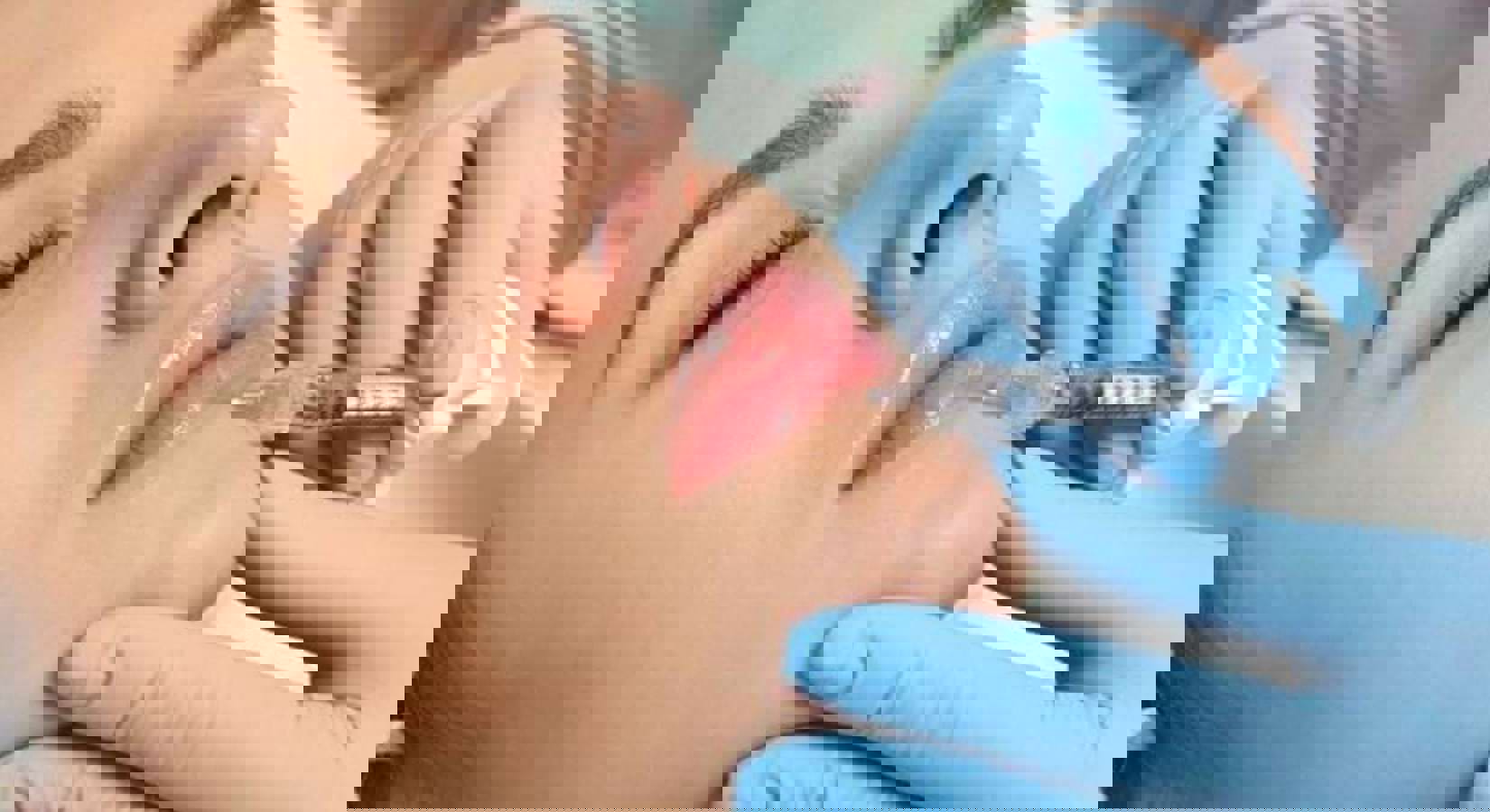Fillers
