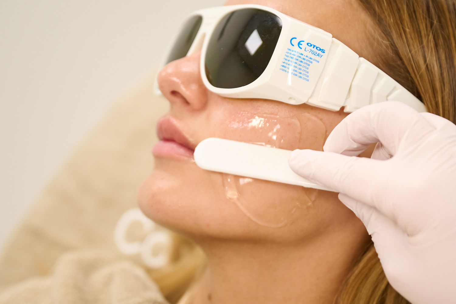 Bovenlip Laser Ontharen Gladde Huid