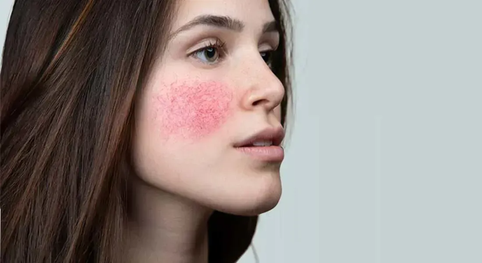 Soins Couperose Valence