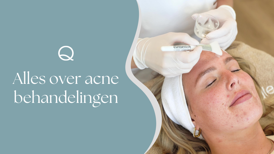 Alles Over Acnebehandelingen Amsterdam