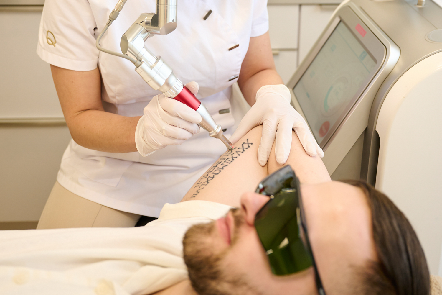 Huid Tattoo Laseren