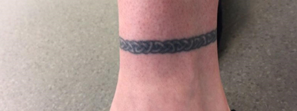 Tattoo 5X