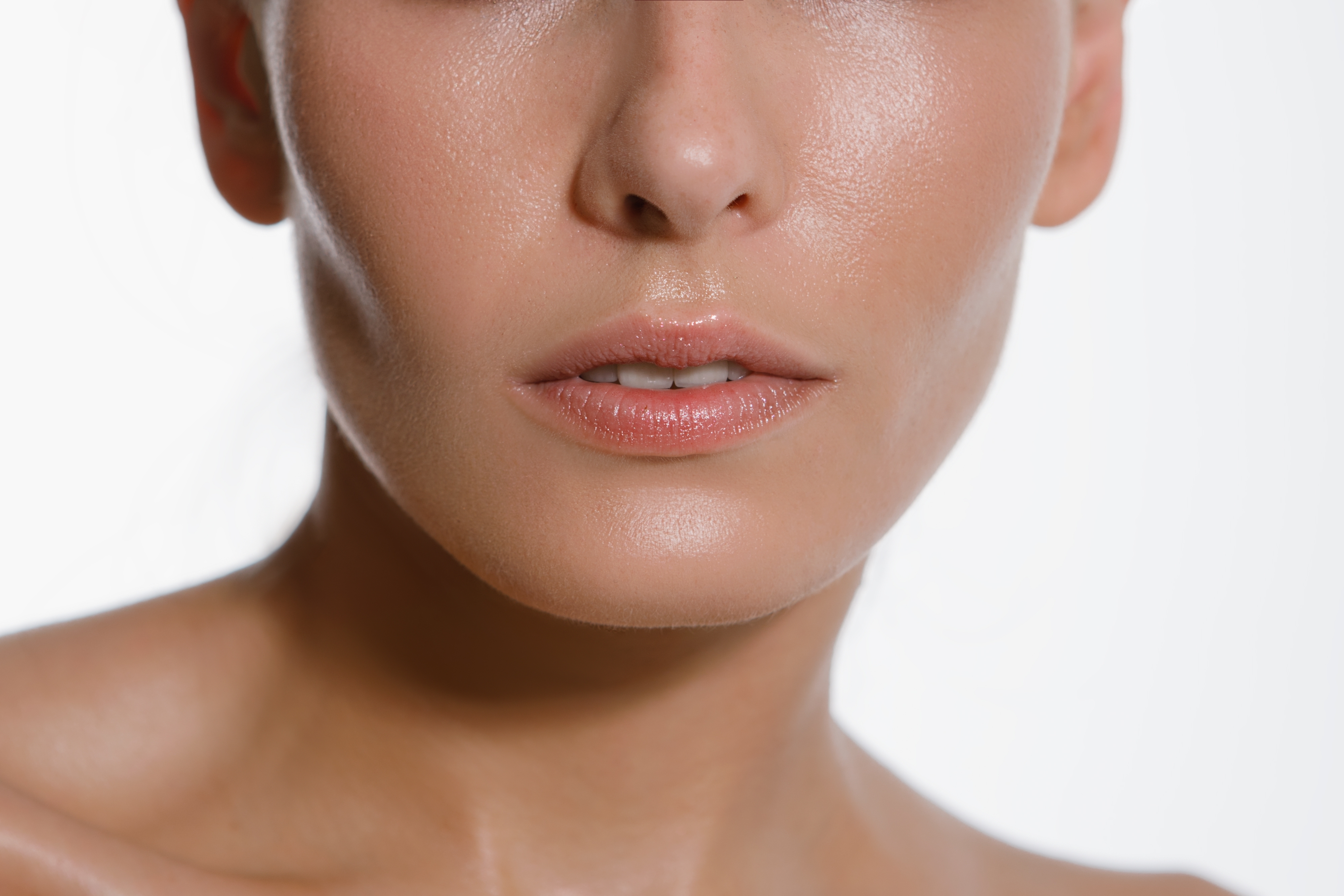 Sublimation des pommettes avec des fillers