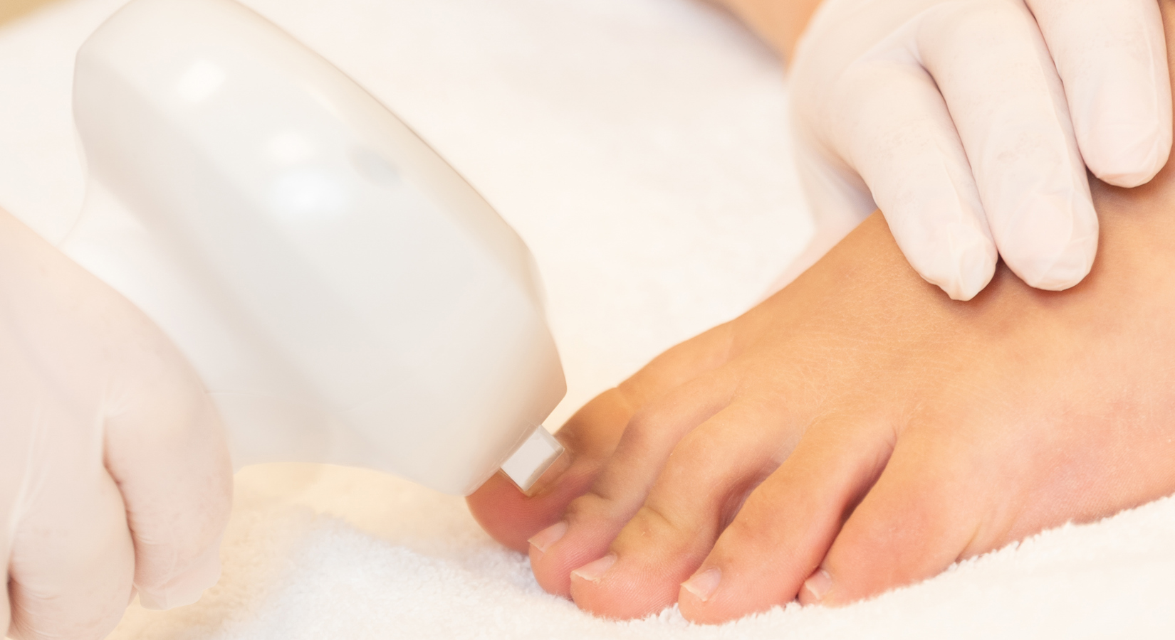 Mycose D'ongle Besancon