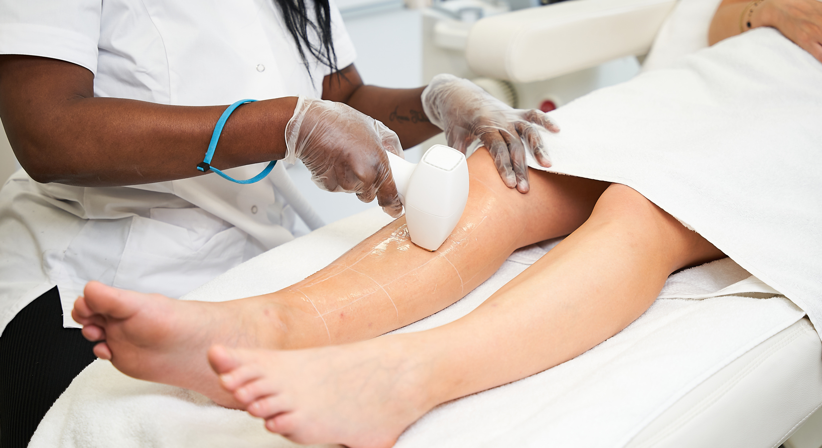 Wat zijn de prijzen van laserontharing?