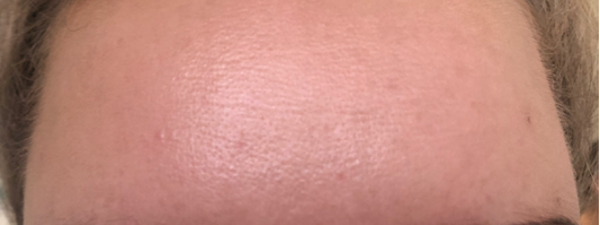 Pigment na