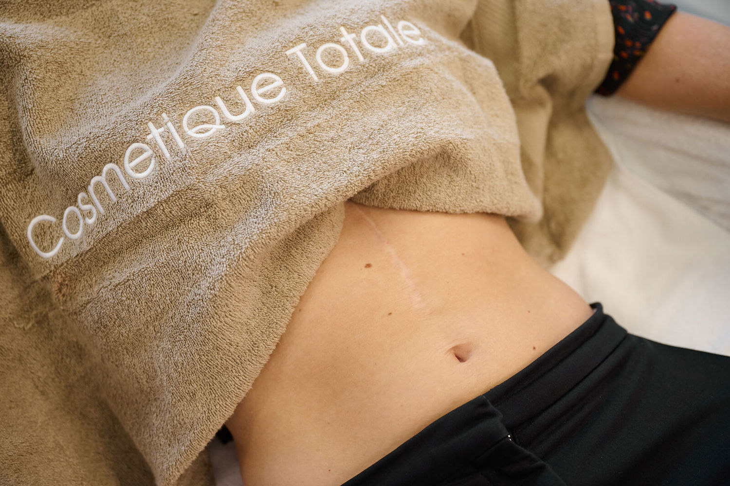 Hoe Ontstaat Een Litteken