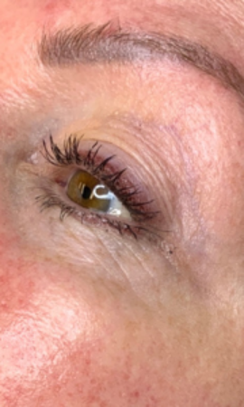 Colorescience Total Eye Treatment Resultaat 1