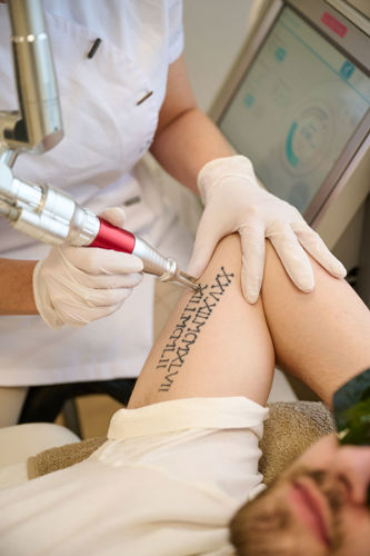 Tattoo Laseren Behandeling Rotterdam