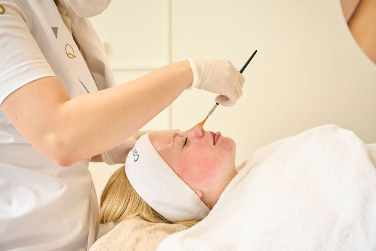 Behandeling Hyperpigmentatie
