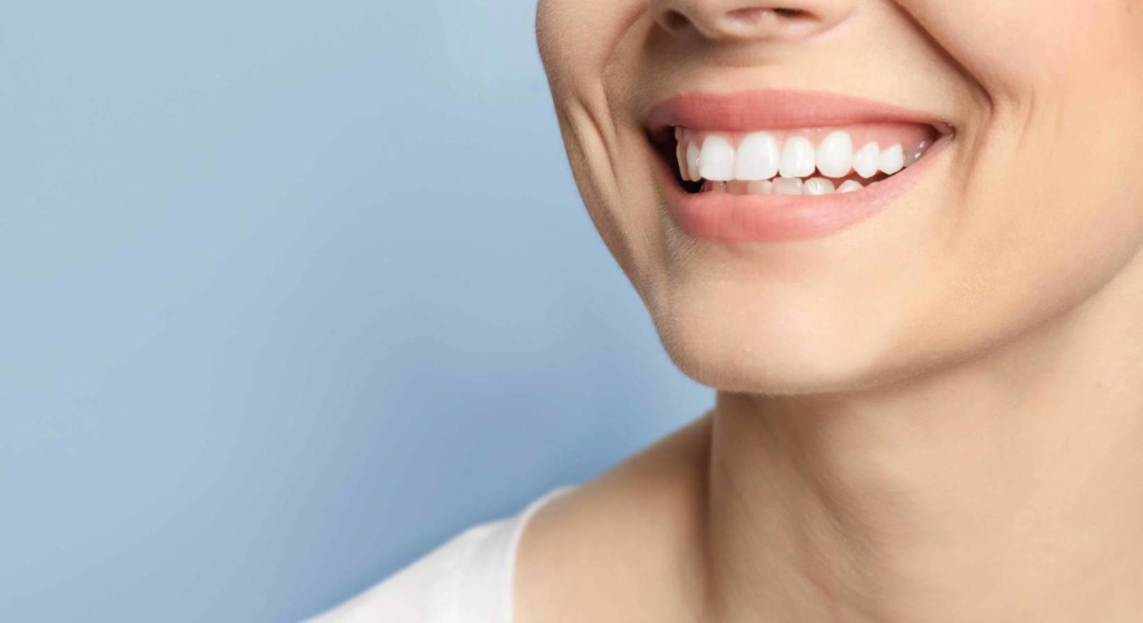 sourire gingival