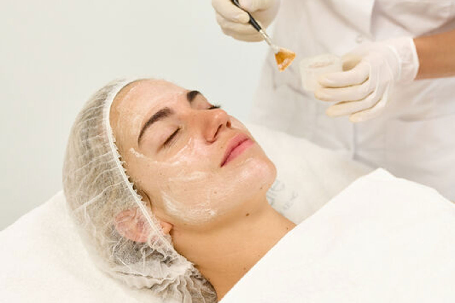 Les Solutions Pigmentation A Cosmetique Totale