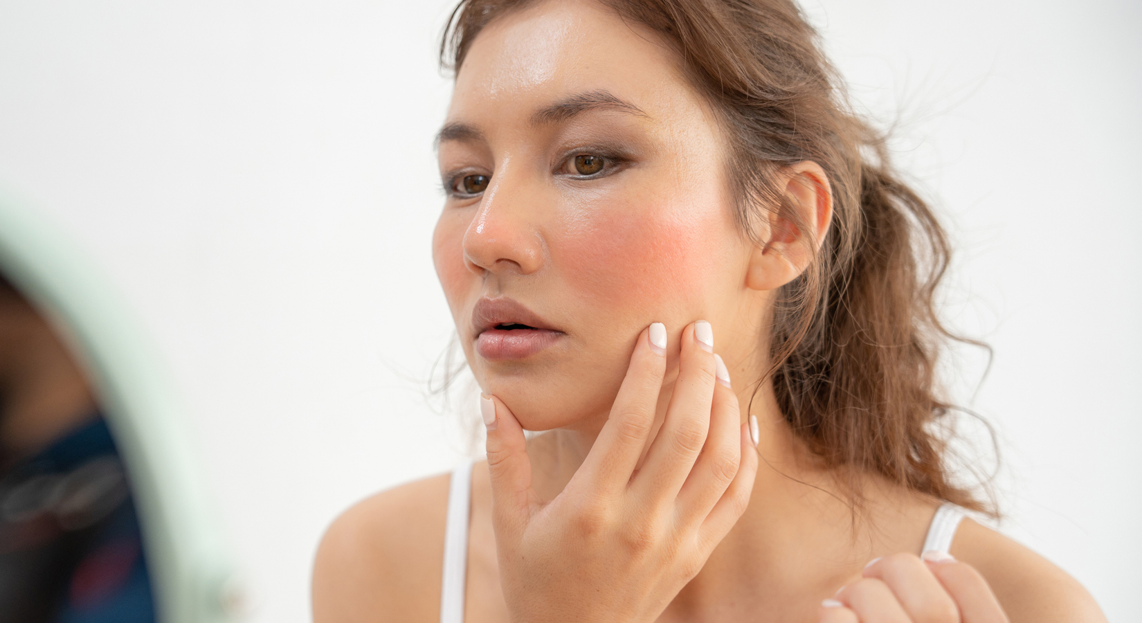 Rode Huid Oorzaken En Behandelingen