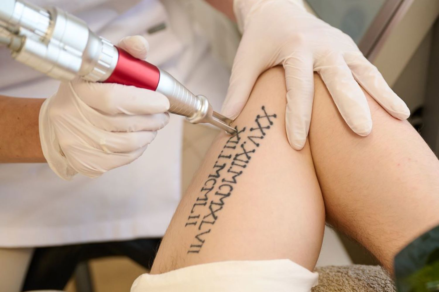 IPL En Laser Do's En Dont's