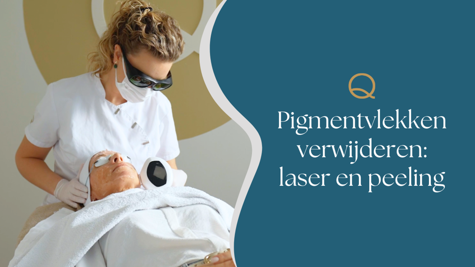Pigmentvlekken Verwijderen Laser Peeling Rotterdam