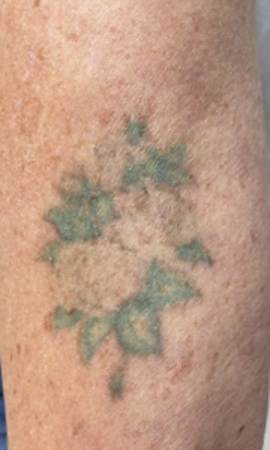 Tattoo 1X32