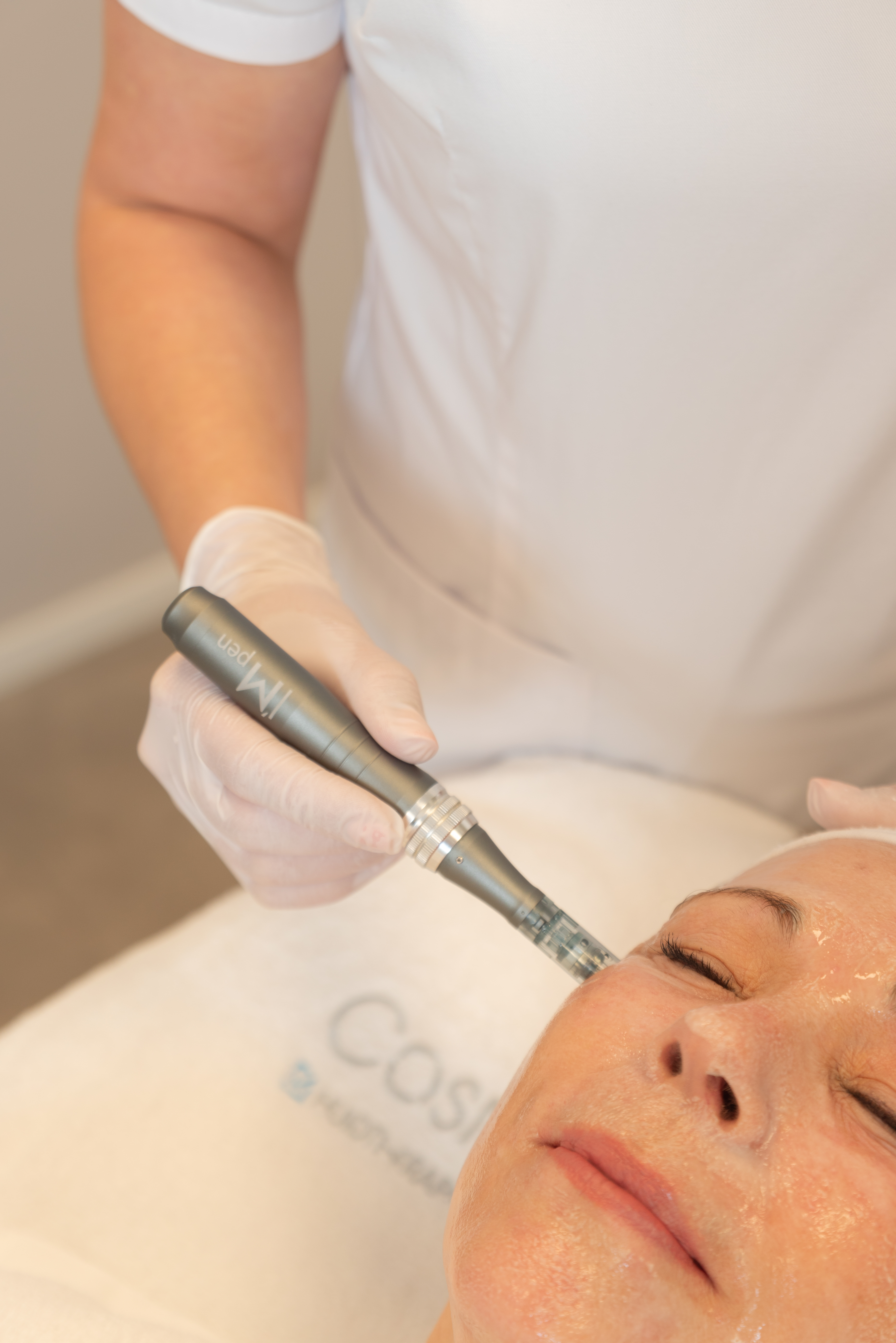 Microneedling